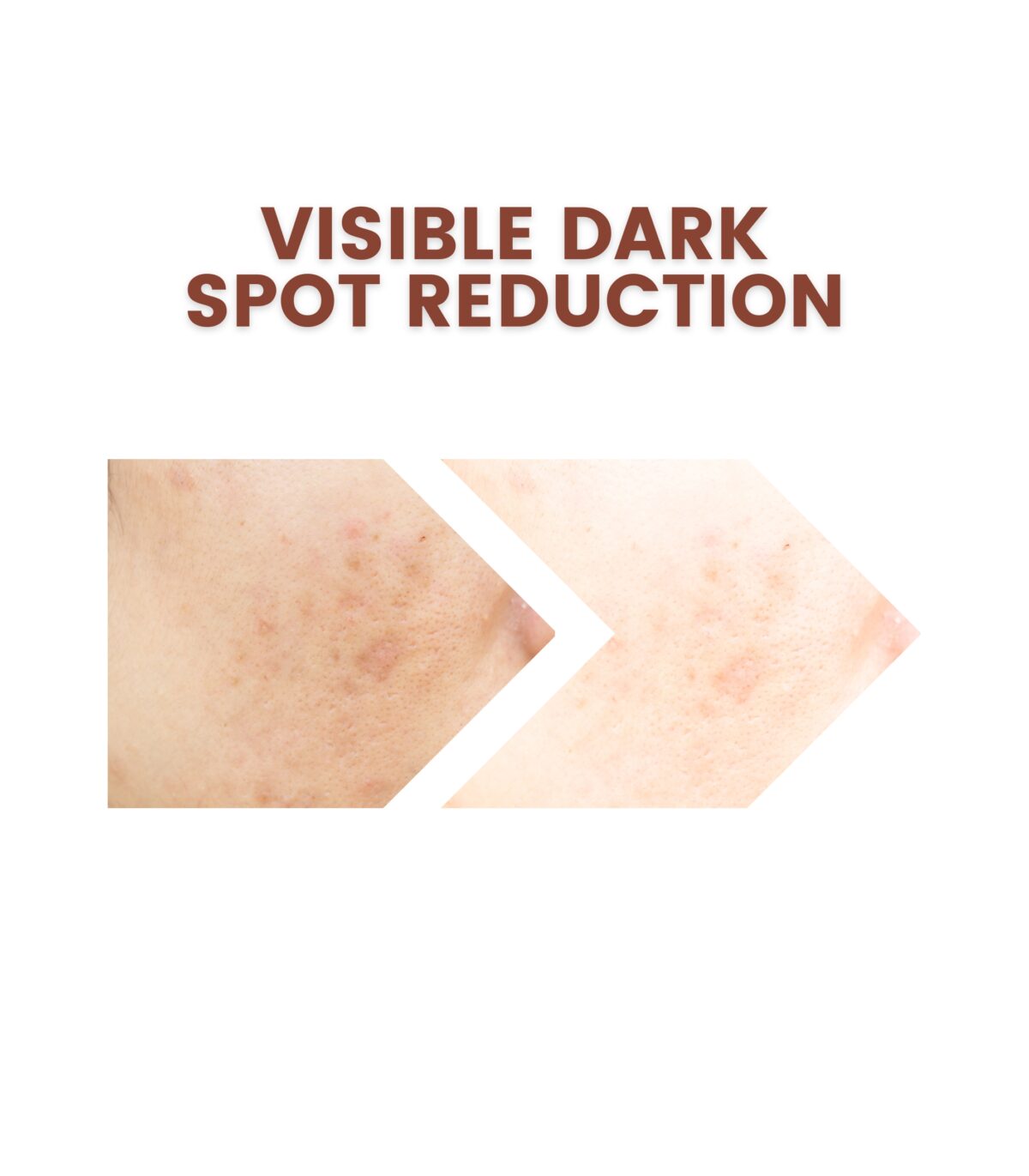 Aureate Beauty Vitamin C Serum - Image 6